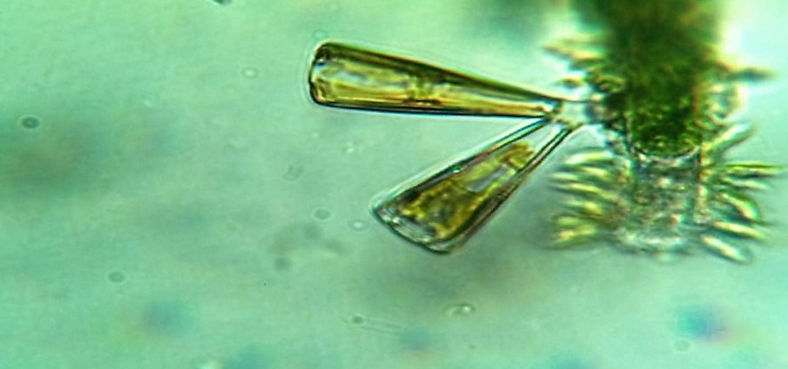 Diatomea Gomphonema truncata